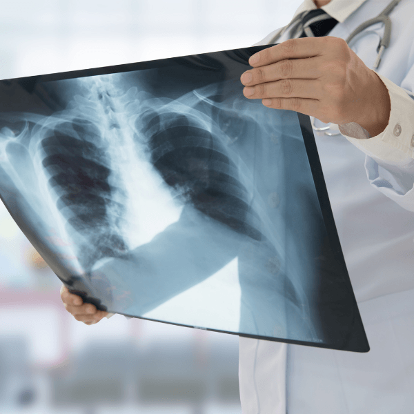 x-ray, ultrasound