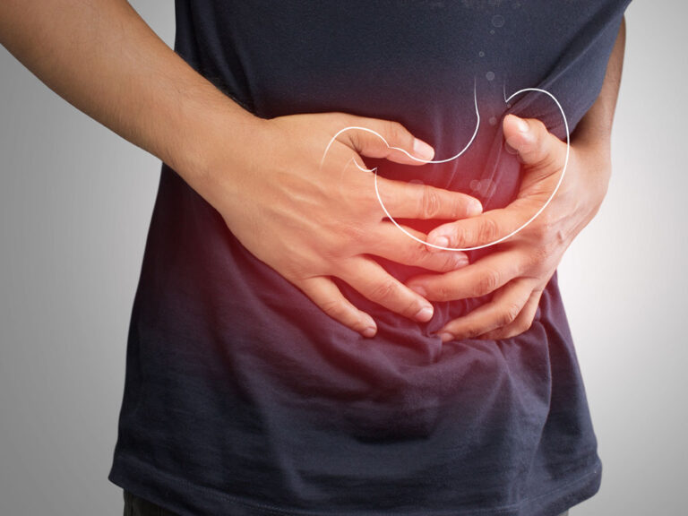 Gastroparesis
